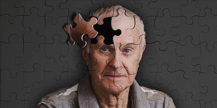 alzheimer hastalığı nedir, belirtileri nelerdir